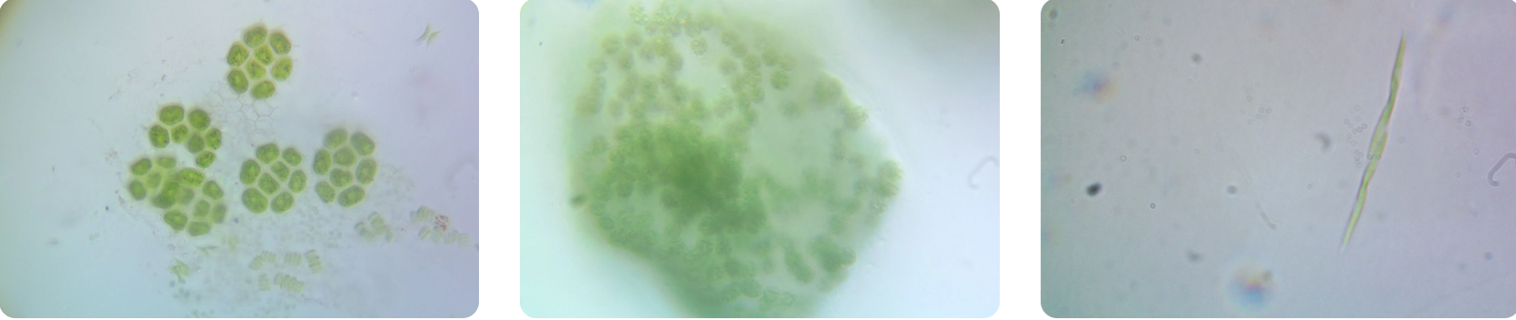 Phytoplankton 1